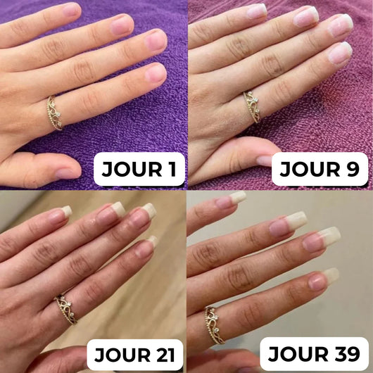 Sérum de Croissance des Ongles | Luma